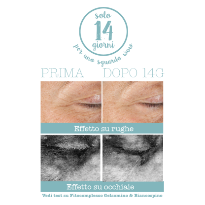 Crema contorno de ojos 3 en 1